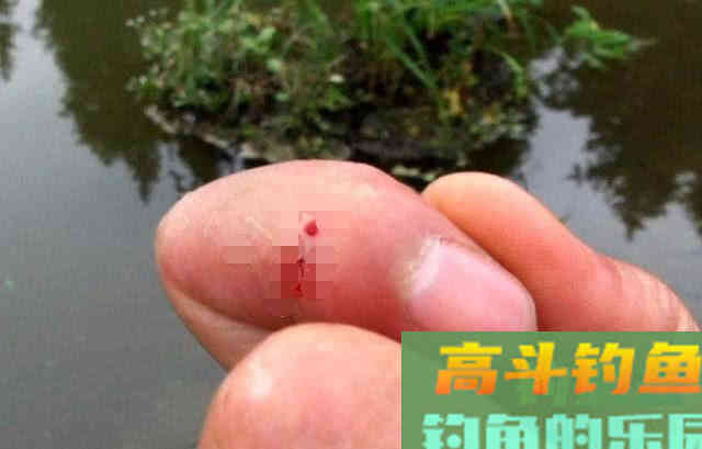 10斤多草鱼把手指伤了值得吗？这次疼入骨髓
