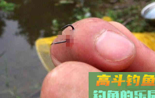 10斤多草鱼把手指伤了值得吗？这次疼入骨髓