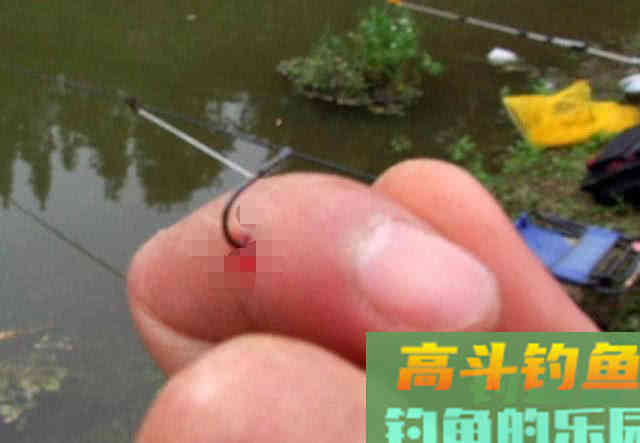 10斤多草鱼把手指伤了值得吗？这次疼入骨髓