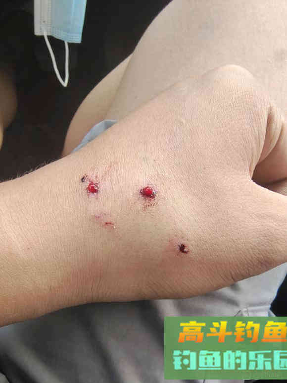秋季毒蛇特别活跃，野钓需留意
