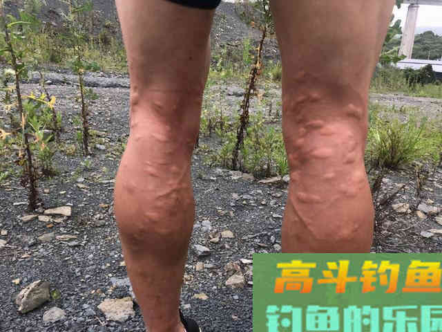 夏天多种蚊虫对钓鱼人有危害，可防可治提升垂钓体验