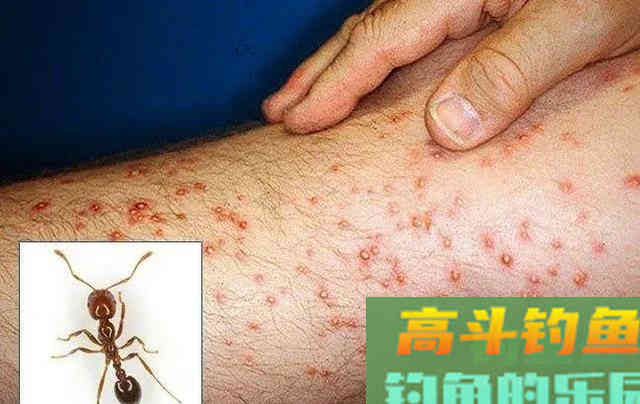 夏季夜钓，提防的不止是蛇与红火蚁