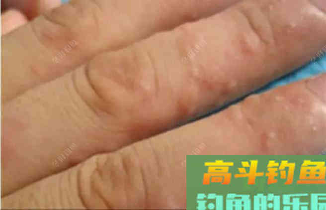 购买和使用商品饵时一定要注意的安全问题