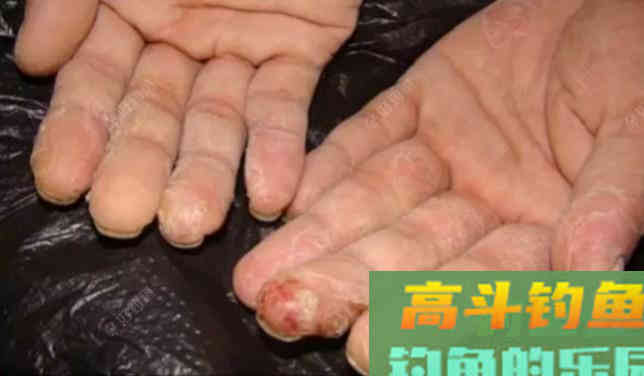 购买和使用商品饵时一定要注意的安全问题